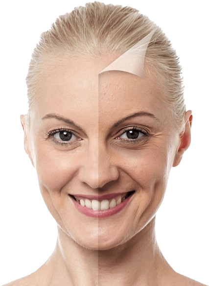 Anti Aging Treatment in Wakad, Pune - Wonder Glow and Smile Clinic